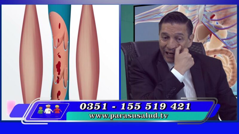 Por qué no se realizan estudios para evitar las varices
