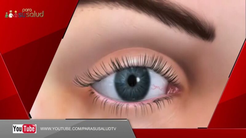 Ojo seco