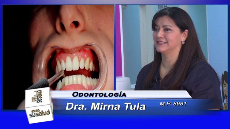 Para tener mis dientes blancos Â¿Blanqueamiento con ozono o carillas?