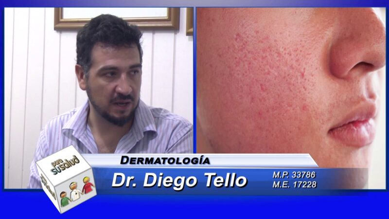 Destapar poros Â¿quÃ© significa en dermatologÃ­a?