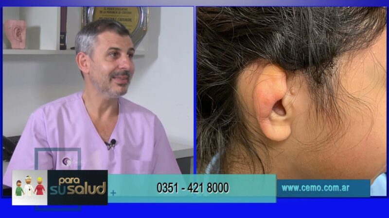 Estética del oído