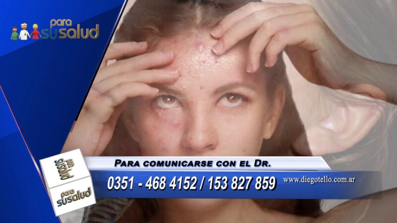 Si tengo acnÃ© Â¿debo concurrir a un dermatÃ³logo?