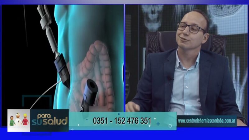 Cirugía de hernia ¿cuanto dura el post operatorio?