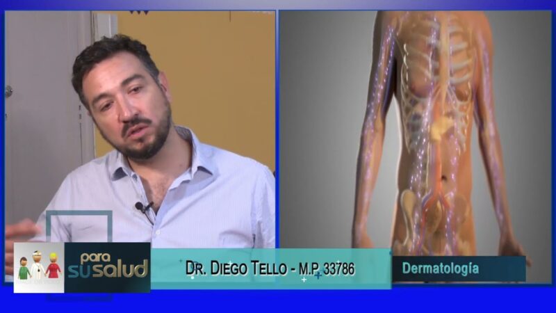 Acné en el adulto
