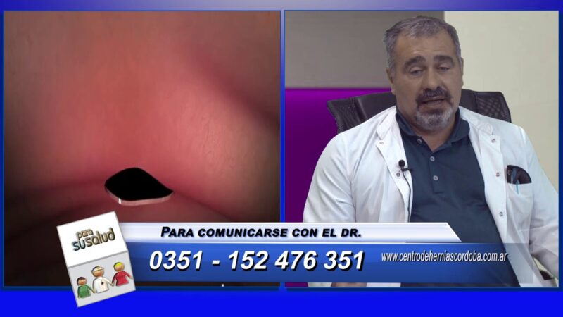 La prÃ³tesis (malla) Â¿es la Ãºnica soluciÃ³n para contener una hernia?