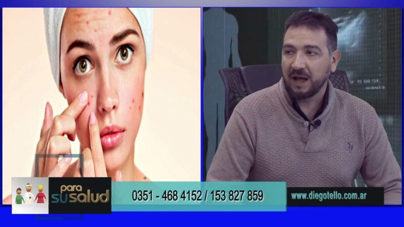Estrés y manifestaciones dermatológicas ¿por donde empezar a tratar?
