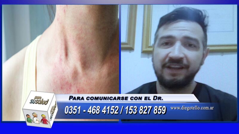 PicazÃ³n en el cuerpo Â¿puede vincularse al higado?