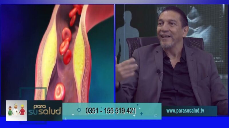 Cirugía de rodilla ¿puede provocar varices?