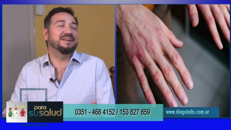 El frío ¿genera enfermedades dermatológicas?