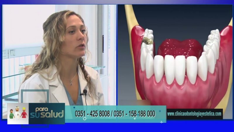 Como resolver un elemento dentario extraído hace años
