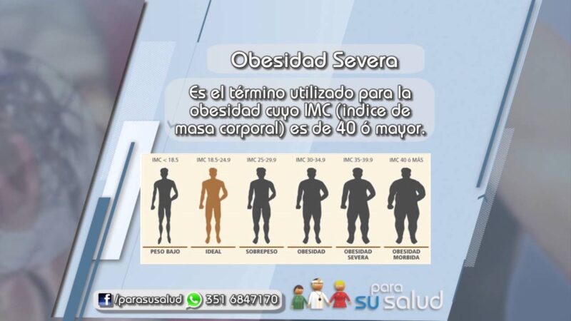 Obesidad y cirugÃ­a