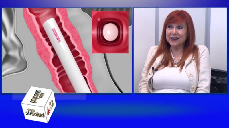Nueva tecnologÃ­a para la atenciÃ³n de prolapsos