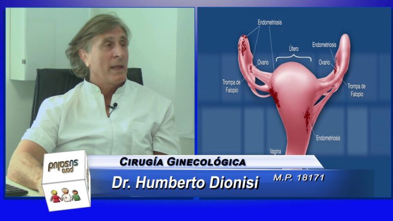 Â¿Se puede tener endometriosis sin tener sÃ­ntomas?