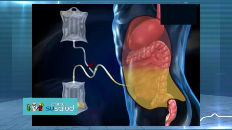 DiÃ¡lisis peritoneal