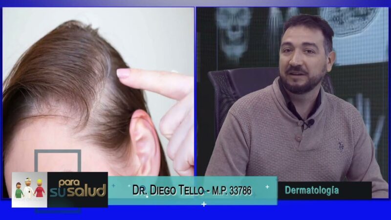 Entre otros factores, las infecciones pueden provocar caída de cabello