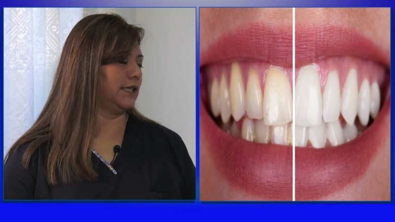 Que no debemos consumir para mantener nuestro blanqueamiento dental
