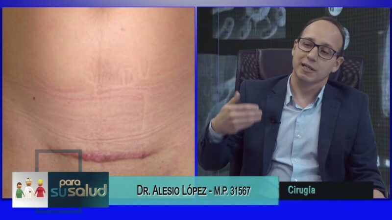 Hernias y cicatriz queloidea