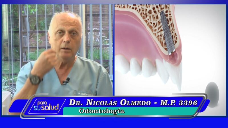 Implantes dentarios