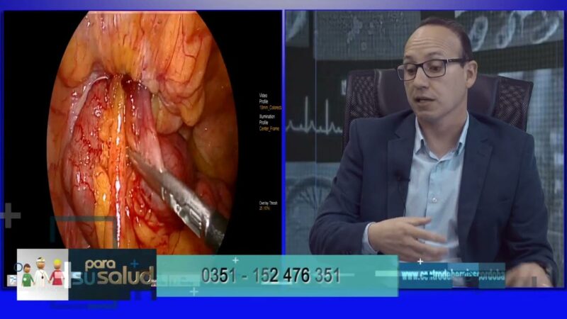 Cómo es el post operatorio de una readecuación de una pared abdominal