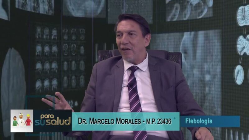 Para tratar las varices ¿vascular periférico o Flebólogo?