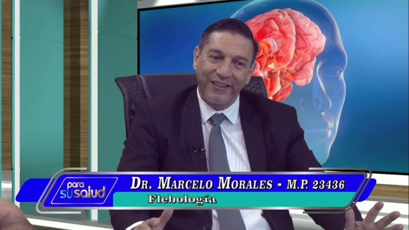 Escleroterapia ¿borra o quita las varices?