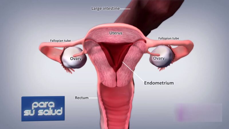 Dolor leve en periodo menstrual, Â¿se considera normal?