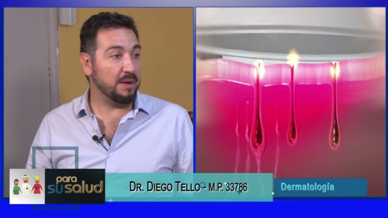 ¿Es conveniente consulta dermatológica previa a depilación definitiva?