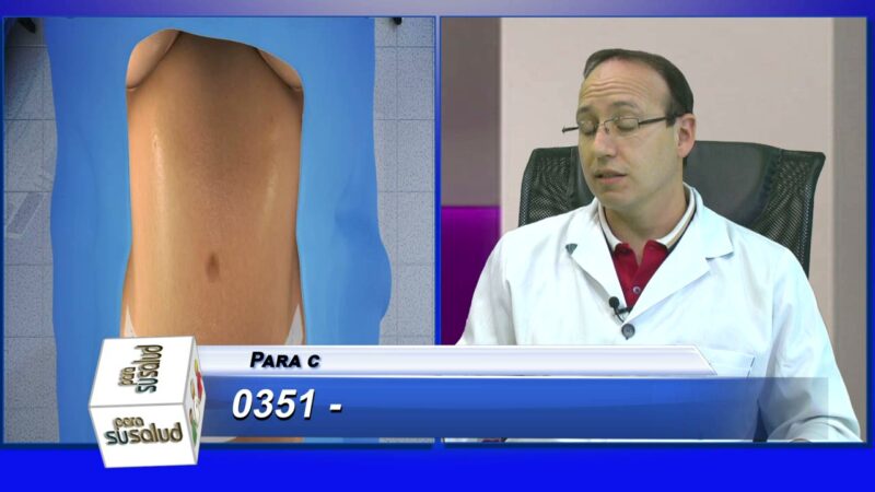 Hernia umbilical post embarazo y posibilidad de cirugÃ­a estÃ©tica