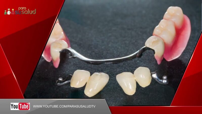 Prótesis removibles versus implantes