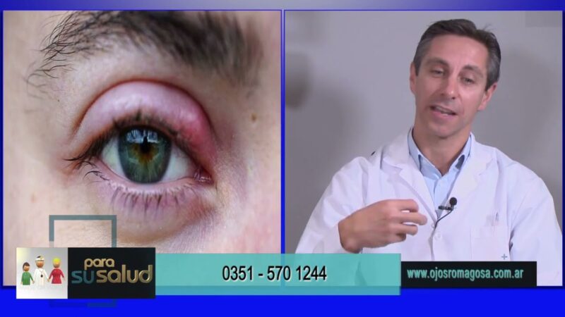 Orzuelo ¿se soluciona con un anillo?