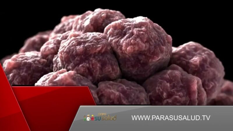 Cáncer de próstata: tomado a tiempo es curable