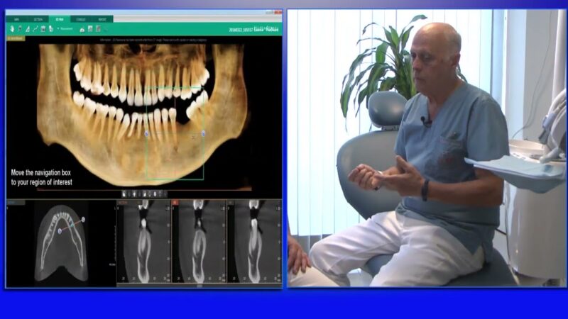 ¿Se tiene en cuenta el contorno del rostro para la estética dental?