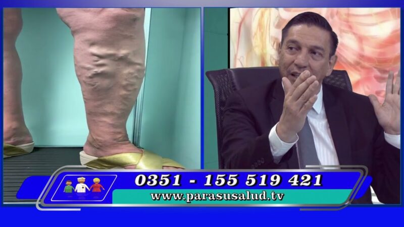 Las varices tratadas ¿pueden volver?