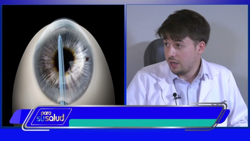 Luego del trasplante de cornea ¿puede volver el queratocono?