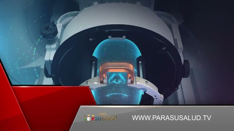 Inteligencia artificial en radioterapia ¿es aplicable?