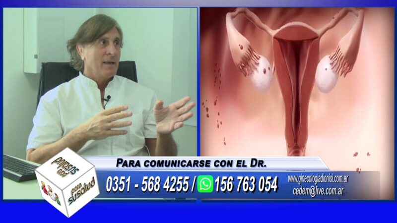 Tratamiento para la endometriosis