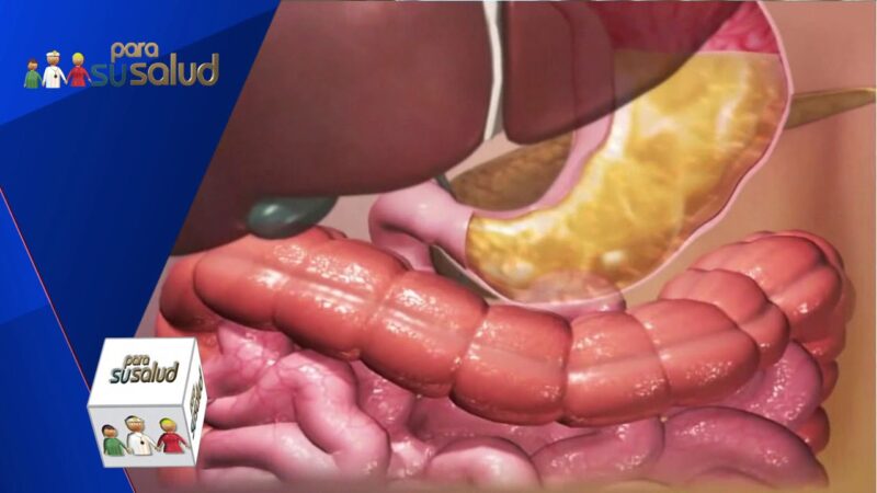 Como encausar el aumento de ingesta ante la cuarentena de obesos mÃ³rbidos