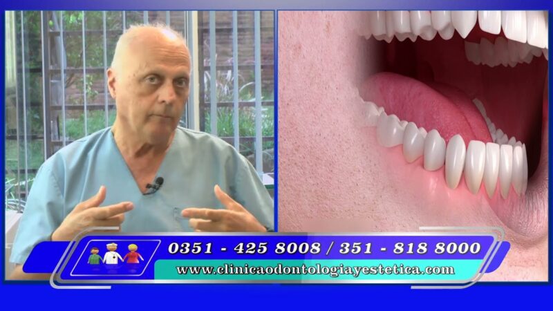 Implantes dentales ¿necesidad funcional o estética?