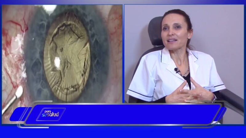 Lentes intraoculares ¿se empañan?