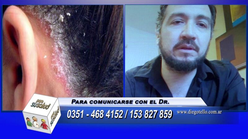 El estrÃ©s generado por la pandemia Â¿disparÃ³ mas enfermedades dermatolÃ³gicas?