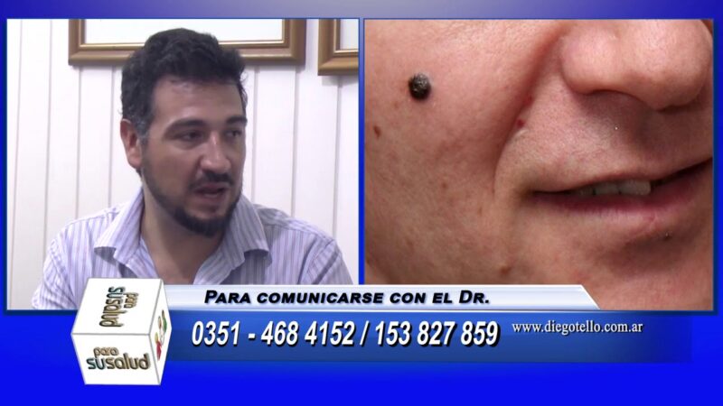 El cÃ¡ncer de piel hace metÃ¡stasis