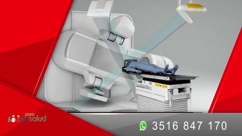 Radioterapia para Parkinson ¿como es el tratamiento?