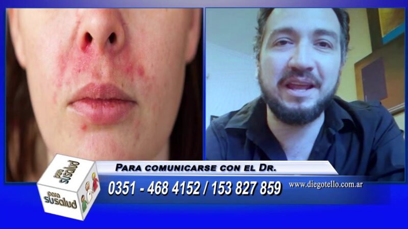 Como es la forma de atenciÃ³n en dermatologÃ­a hoy