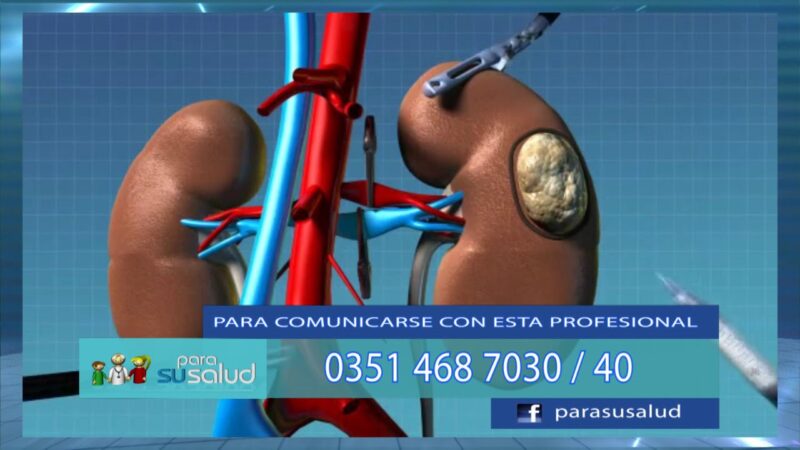 Sin riÃ±ones, puede viuvir una persona