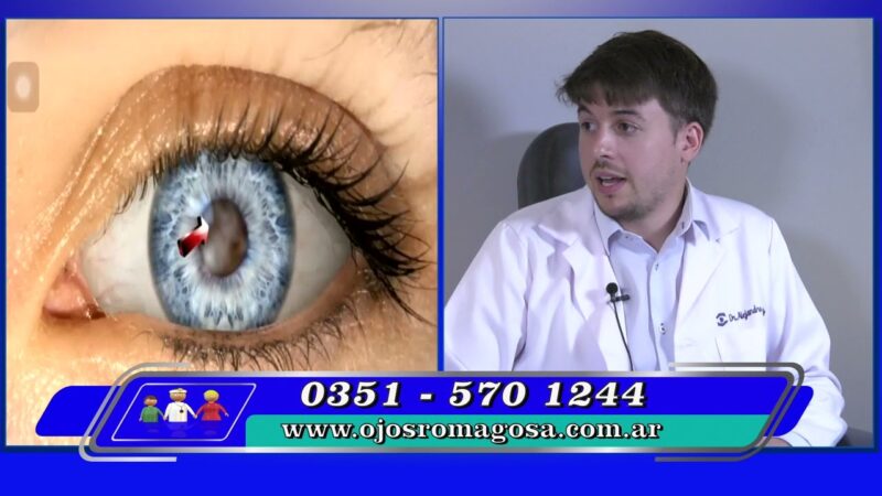 Trasplante de cornea