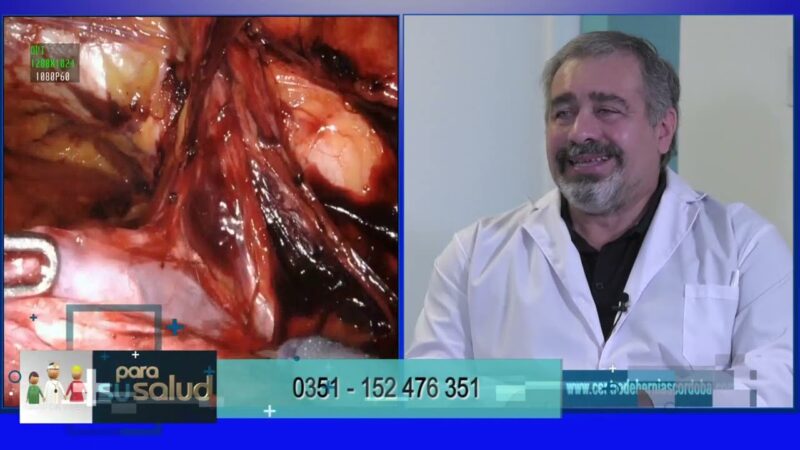Hernias incisionales ¿se pueden prevenir?