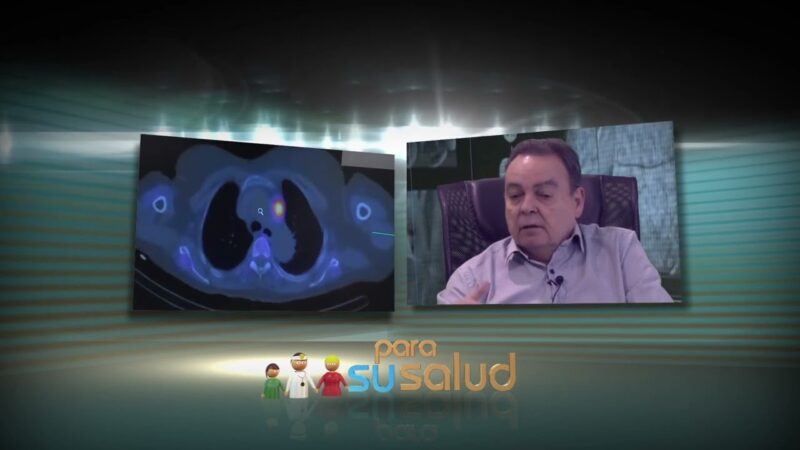Cámara gamma o ecocardiografía