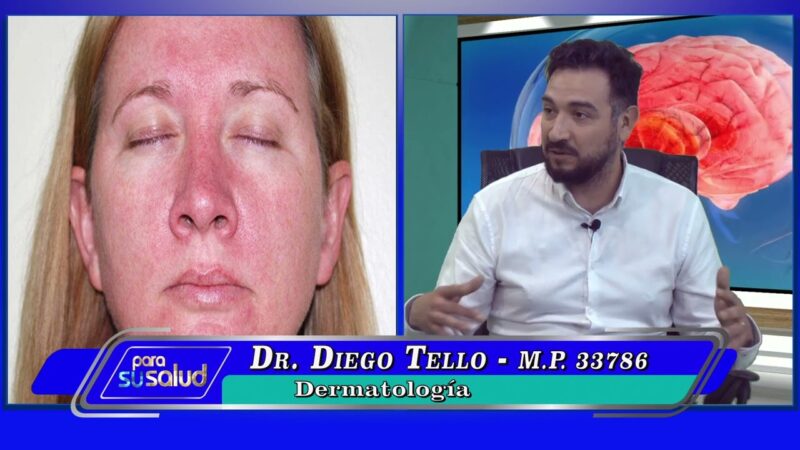 Enrojecimiento del rostro por calor ¿será una rosácea?