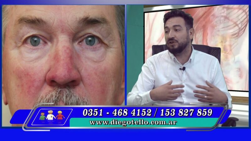 Rosacea ¿se cura?