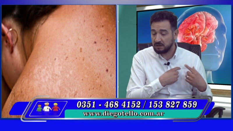 Como detectar un posible cáncer superficial de piel